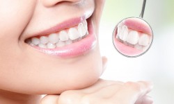 גלינה-גובר-מרפאת-שיניים-הלבנה